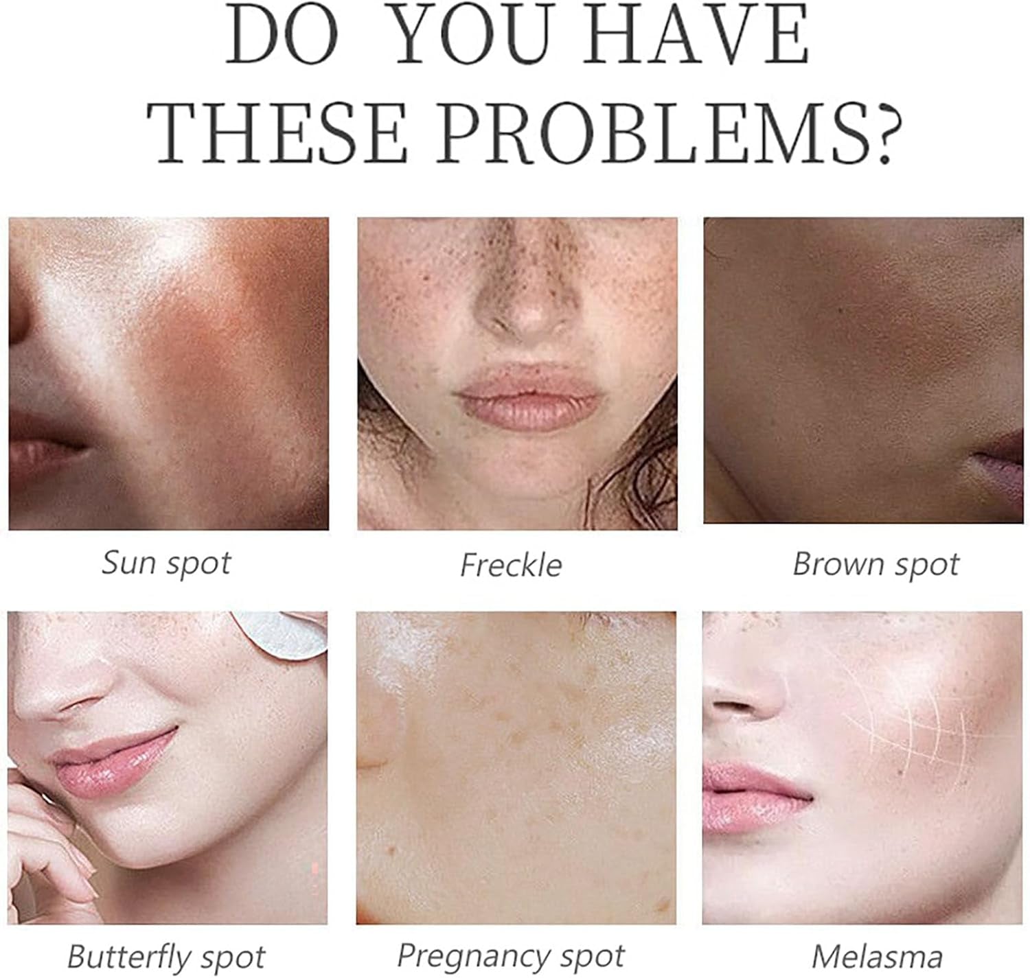 Kojic Acid Serum - Collagen Face Serum for Skin Lig_Htening - anti Aging Face Serum - Dark Spot Correcting Glow Serum - Hydrating Serum - Facial Serum for Firming, Moisturising, Nourishing (30Ml)