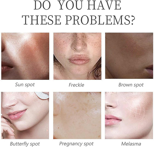 Kojic Acid Serum - Collagen Face Serum for Skin Lig_Htening - anti Aging Face Serum - Dark Spot Correcting Glow Serum - Hydrating Serum - Facial Serum for Firming, Moisturising, Nourishing (30Ml)